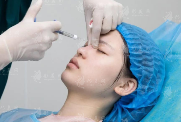 上海九院注射玻尿酸多少錢？