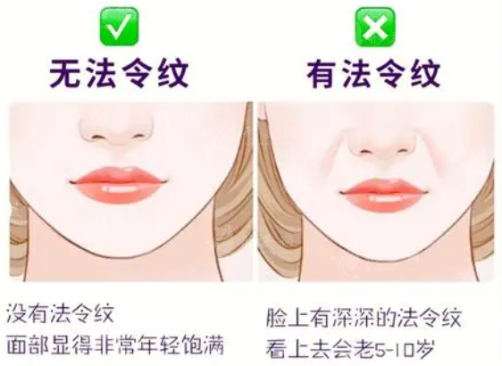 上海去除法令紋哪家醫(yī)院好？