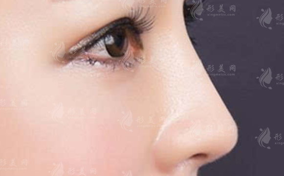 肋軟骨隆鼻可以用別人的嗎？會有什么區(qū)別嗎？