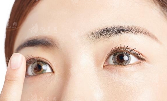 雙眼皮埋線般需要多少錢？做完能維持幾年？