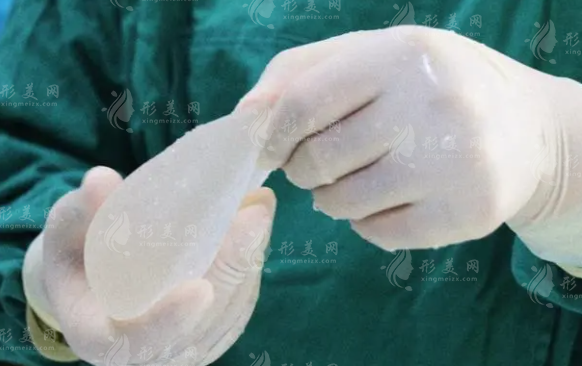 曼托假體豐胸價格是多少?影響價格的因素來了~