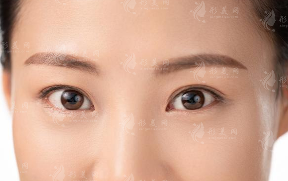 開(kāi)內(nèi)眼角有增生怎么辦?它會(huì)自行消失嗎?