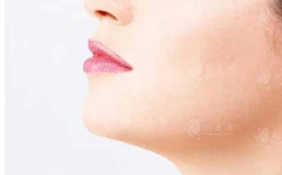 墊下巴多長(zhǎng)時(shí)間恢復(fù)?效果怎么樣?
