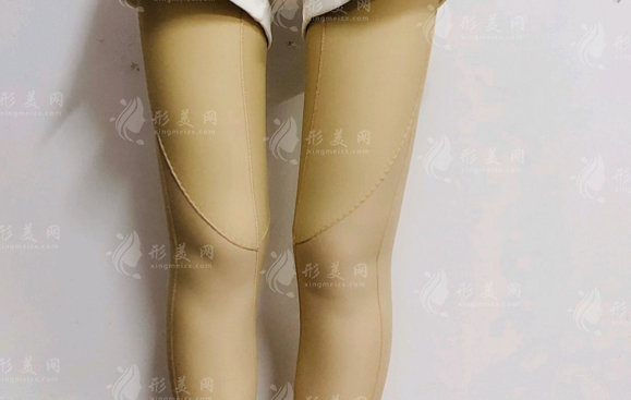 大腿抽脂和水動(dòng)力環(huán)吸哪個(gè)比較好？