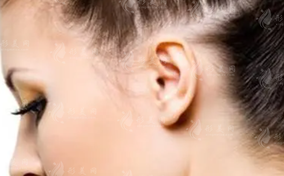 全耳再造手術(shù)費(fèi)用大概是多少?