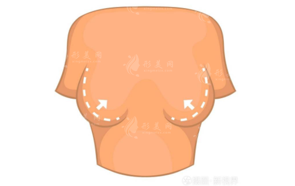 北京八大處整形胸部下垂矯正怎么樣？醫(yī)生資料、項(xiàng)目表一覽