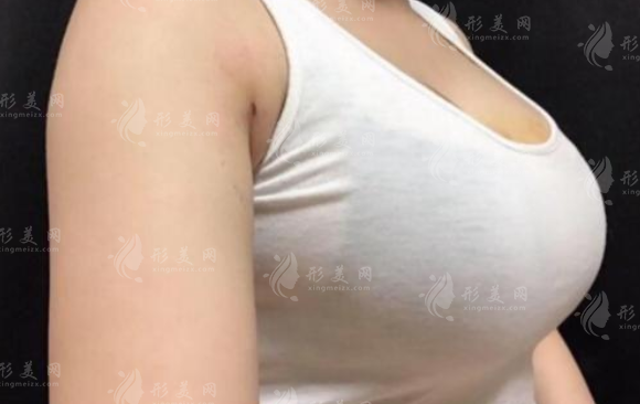 鄭州華領(lǐng)整形隆胸怎么樣？坐診醫(yī)生、項目詳情、收費價格表