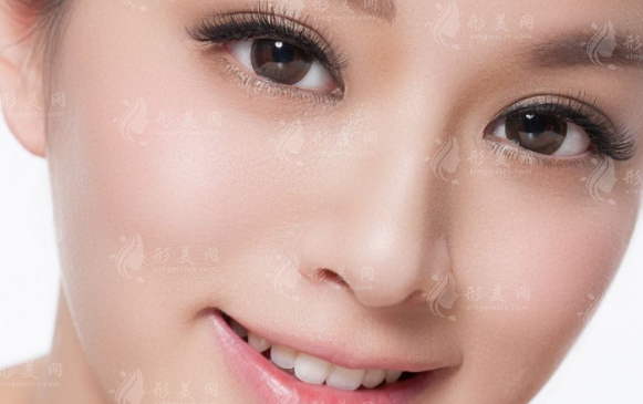 假體隆鼻硅膠和膨體的深入揭秘：區(qū)別、優(yōu)缺點及價格解析