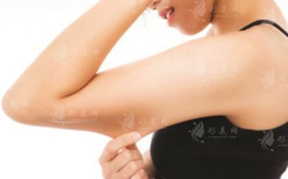 蝴蝶袖手臂吸脂：價(jià)格、保持時(shí)間與恢復(fù)期深度解析