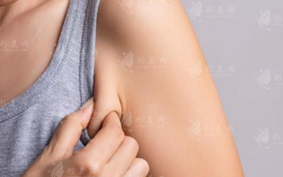 副乳吸脂有風(fēng)險(xiǎn)嗎？怎么降低手術(shù)中的風(fēng)險(xiǎn)？