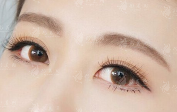 切眉術(shù)適合多大年齡做？對于年齡有要求嗎？