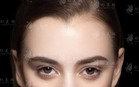 種植美人尖需要多少錢？與哪些因素有關(guān)？