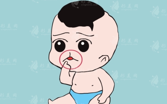 兔唇手術(shù)費(fèi)用解析：價(jià)格高低與哪些因素有關(guān)？