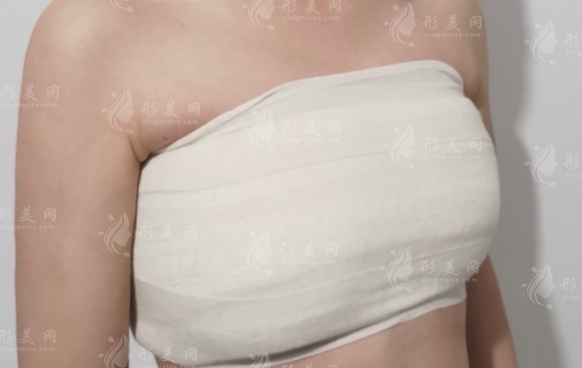 自體隆胸手感和真的一樣嗎？一般要多長時(shí)間可以恢復(fù)？