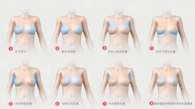 北京八大處乳房整形醫(yī)生排名:探尋欒杰與穆大力的精湛技藝 北京八大處乳房整形醫(yī)生排名:探尋欒杰與穆大力的精湛技藝