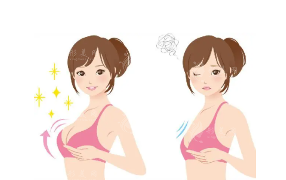 重慶松山醫(yī)院整形豐胸怎么樣？醫(yī)生名單+案例分享+收費價格表