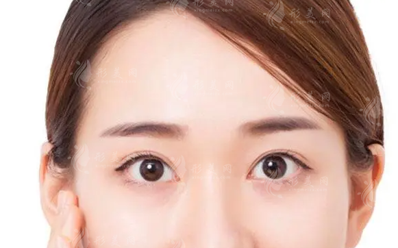 玻尿酸豐額頭需要做幾次？需要多少毫升(ml)？