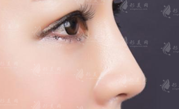 耳軟骨墊鼻尖有什么原理，會穿透鼻尖嗎？