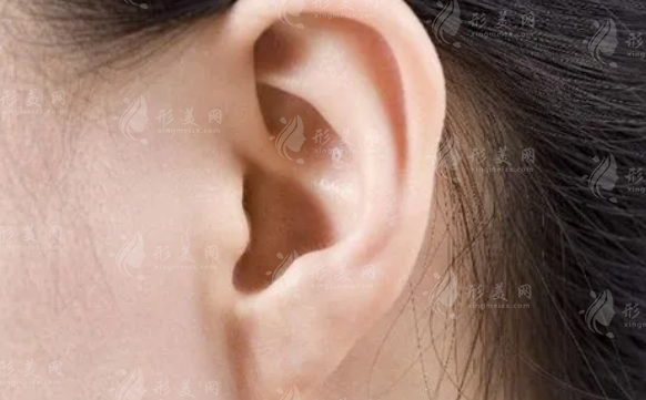 玻尿酸豐耳垂：危險(xiǎn)與栓塞的風(fēng)險(xiǎn)分析
