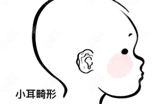 上海九院耳再造技術(shù)怎么樣？專家介紹、案例參考、附收費價格表