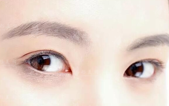 哪些因素會影響自體脂肪隆眉弓的恢復(fù)期 哪些因素會影響自體脂肪隆眉弓的恢復(fù)期