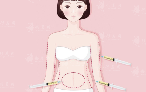 武漢仁愛時光整形吸脂怎么樣？醫(yī)生名單、案例分享、價格表更新