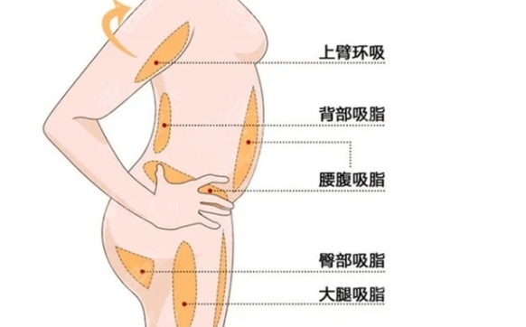 自體脂肪成活率與哪些因素有關(guān)