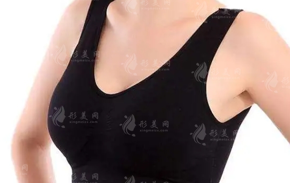 乳暈整形：解讀乳暈擴(kuò)大現(xiàn)象與整形手術(shù)