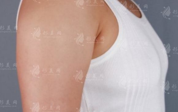 胸部下垂的原因與豐胸手術(shù)過程解析