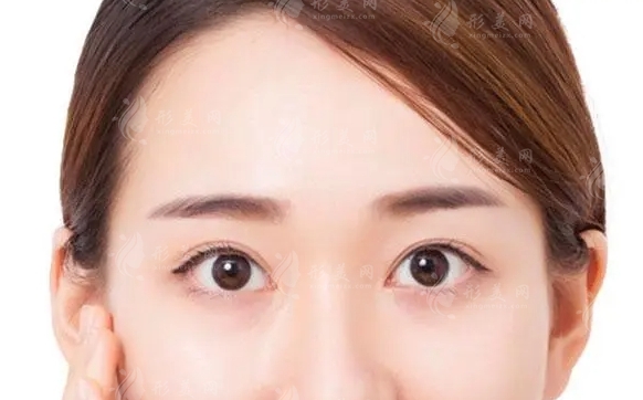額頭整形：哪些類型的額頭需要整形手術(shù)