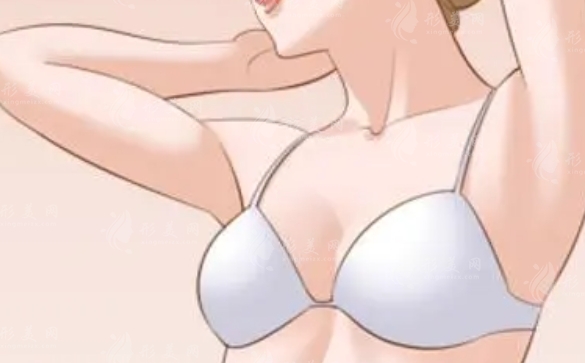 胸部下垂與乳房松弛的應對策略