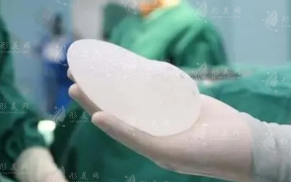 隆胸假體不合格導(dǎo)致滲漏：能否修復(fù)及如何預(yù)防