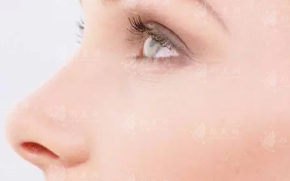 注射縮小鼻尖的效果與風險分析