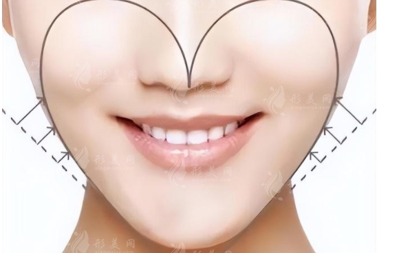 探索填充蘋(píng)果肌價(jià)格的影響因素
