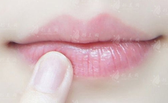 嘴角上揚整形手術(shù)：微笑背后的原理與費用考量