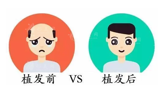 廣州市荔灣人民醫(yī)院植發(fā)怎么樣？技術(shù)卓越，預(yù)約便捷，毛囊價(jià)格透明