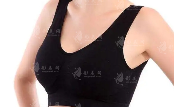乳暈縮小手術(shù)效果及禁忌癥分析