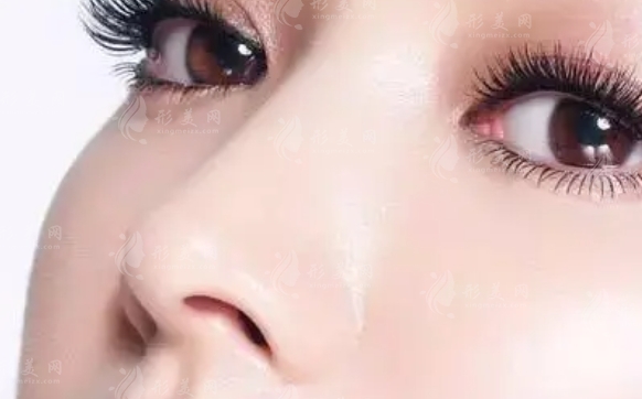 肋軟骨隆鼻保持多久時間？會變形嗎？