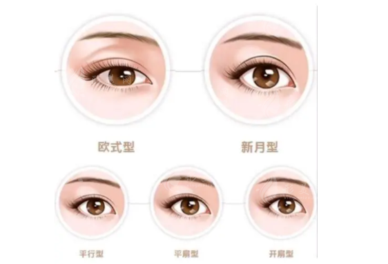 雙眼皮整形