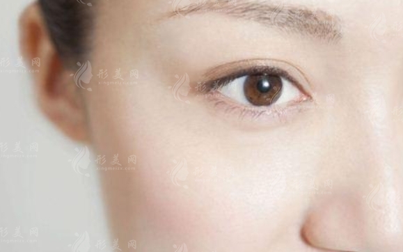 激光去除眼袋和黑眼圈的恢復(fù)時(shí)間探討