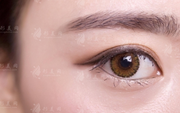 開眼角多久可以戴隱形眼鏡？術(shù)后如何護(hù)理好？