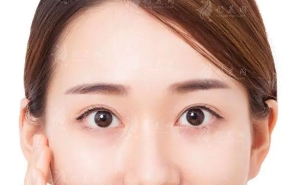 額部填充的材料及其價格：上班族能否負擔(dān)得起？