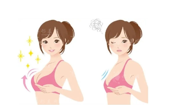 隆胸手術(shù)：內(nèi)窺鏡與無內(nèi)窺鏡的對比及疼痛分析