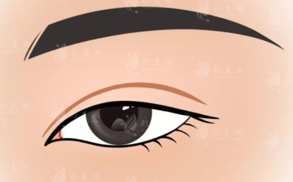 上海時(shí)光整形雙眼皮怎么樣？醫(yī)生名單揭曉、案例分享、收費(fèi)表