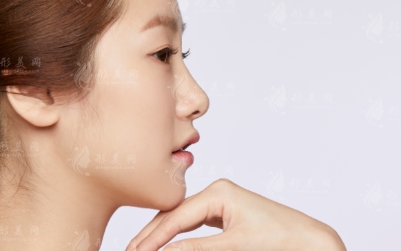 隆鼻后假體取出鼻子是否會變形？