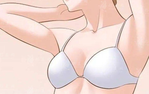 隆胸手術(shù)后多久才能恢復(fù)正常及術(shù)后注意事項