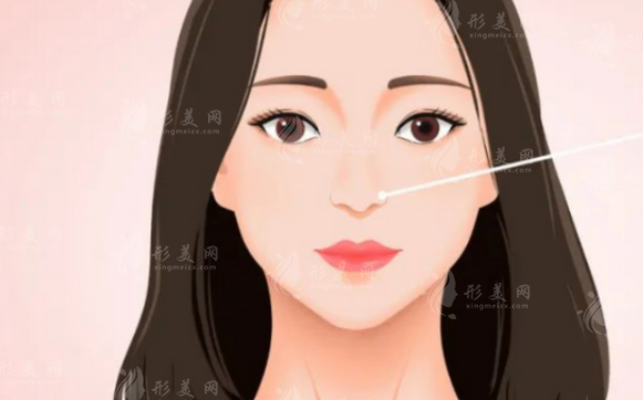 長(zhǎng)沙雅美整形做鼻子怎么樣？醫(yī)生信息、案例分享、價(jià)格表