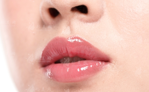 玻尿酸豐唇何時會軟化？