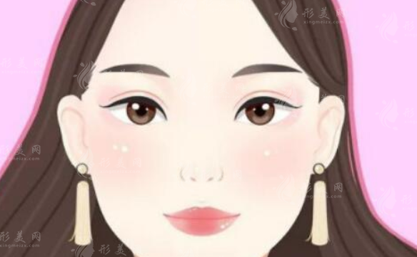 南京康美整形雙眼皮怎么樣？專家醫(yī)生、雙眼皮案例、價(jià)格表