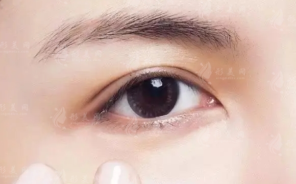 自體脂肪填充淚溝的維持時間：決定因素解析
